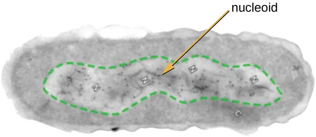 Nuceloid micrograph. Description below.