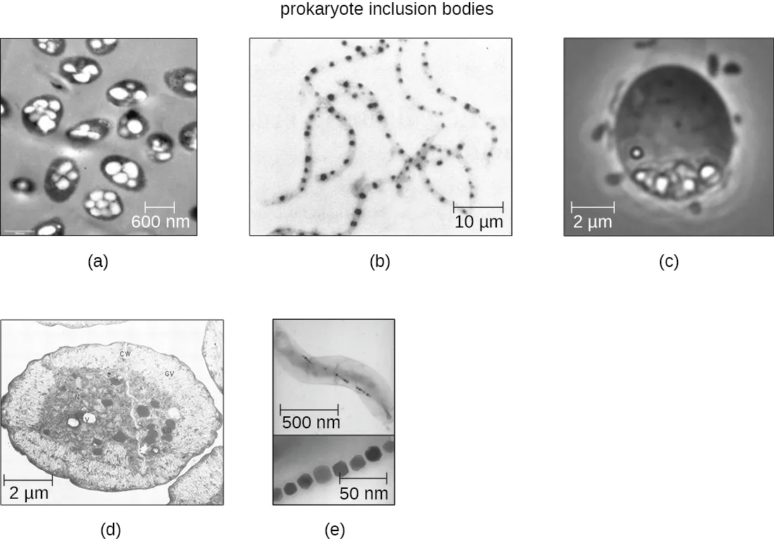 Inclusion bodies. Description below.