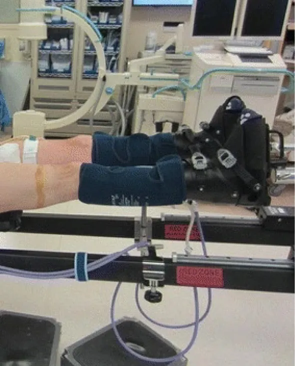 Photo of compression stockings being used on a patient in a medical setting.