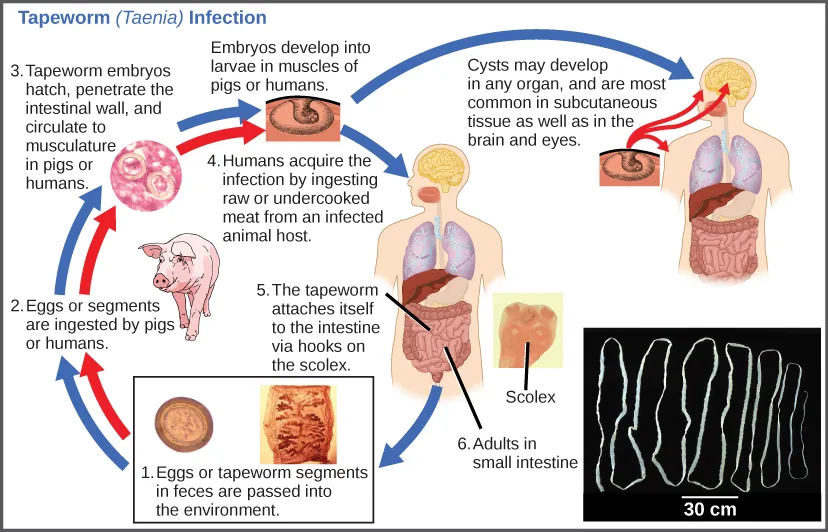 The life cycle of a tapeworm begins when eggs or tapeworm segments in the feces (1) are ingested by pigs or humans (2). The embryos hatch, penetrate the intestinal wall, and circulate to the musculature in both pigs and humans (3). This figure shows how humans may acquire a tapeworm infection by ingesting raw or undercooked meat (4). Infection may result in cysts in the musculature, brains, and eyes, or in tapeworms in the intestine. Tapeworms attach themselves to the intestine via a hook-like structure called the scolex (5). Adult tapeworms are then present in the small intestine (6). Tapeworm segments and eggs are excreted in the feces, completing the cycle.
