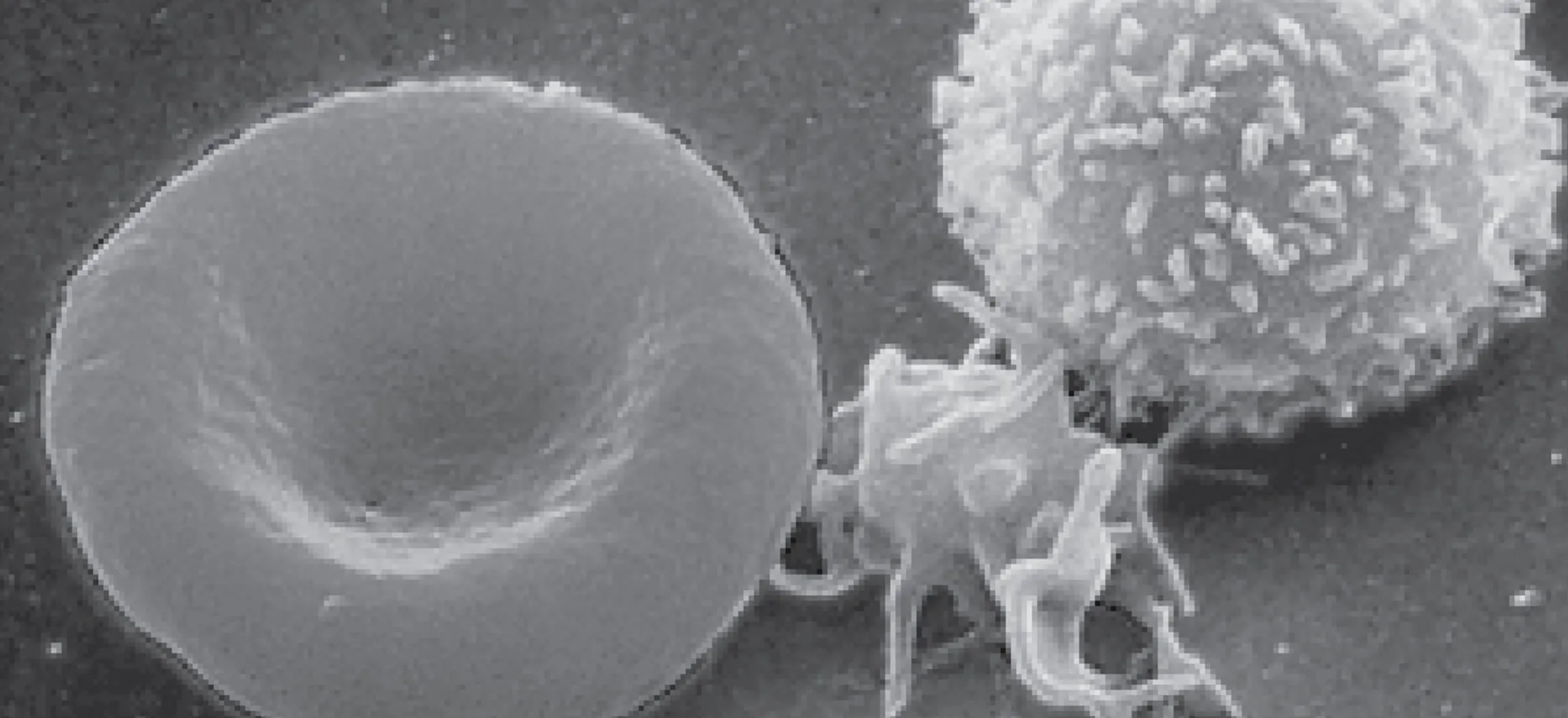 This photo shows a red blood cell and a white blood cell.