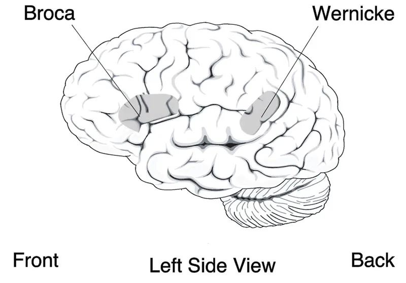 A diagram of a brain is labeled to show the Broca and Wernicke areas. The Broca area controls articulate speech function and the Wernicke area controls the comprehension of speech.