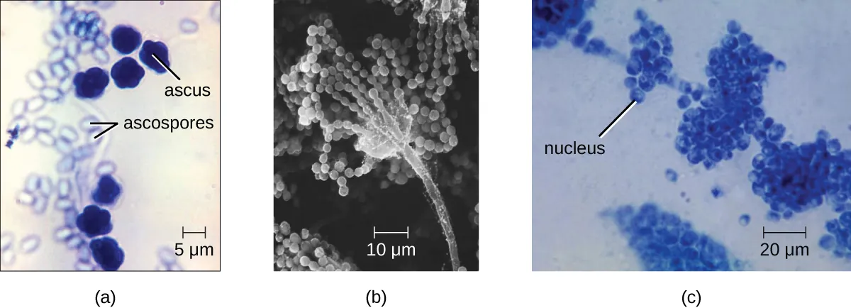 Saccharomyces yeasts. Description below.