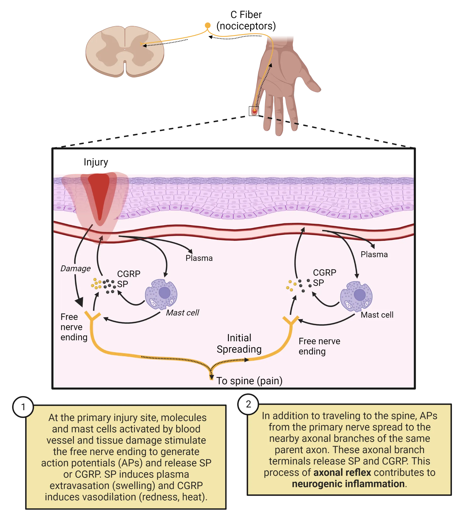Top: Diagram of a C fiber cell body extending process in to the dorsal spinal cord and a separate process in to the tip of a finger. Bottom: Cross-section of skin diagram, with an injury represented that disrupts the surface layers and blood vessels. Mast cells are shown beneath the blood vessels releasing CGRP and SP in response to bleeding. Activation of free-nerve endings also shown.