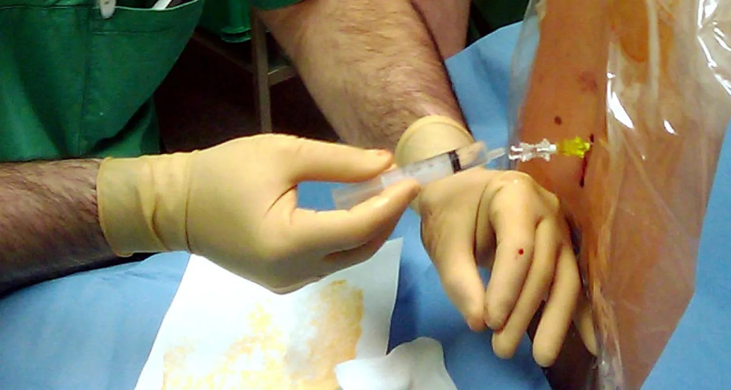 Photo of a medical professional performing a lumbar puncture into an individual’s back.