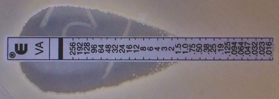 The Etest. Description below.