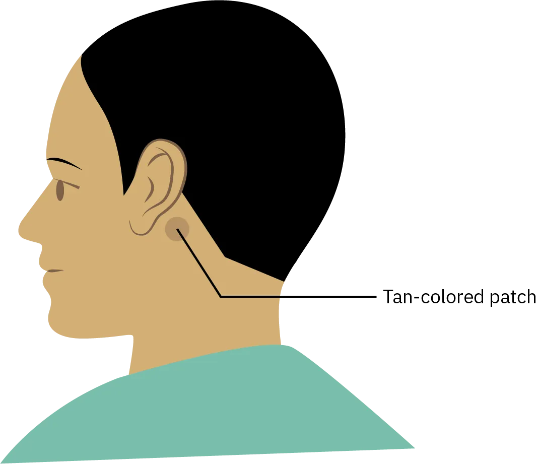 A profile of a person's face and neck shows a small circular-shaped patch placed behind the ear.