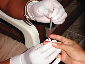 A photograph shows a person’s hand being held by a person wearing medical gloves. A thin glass tube is pressed against the persons finger and blood is moving up the tube.