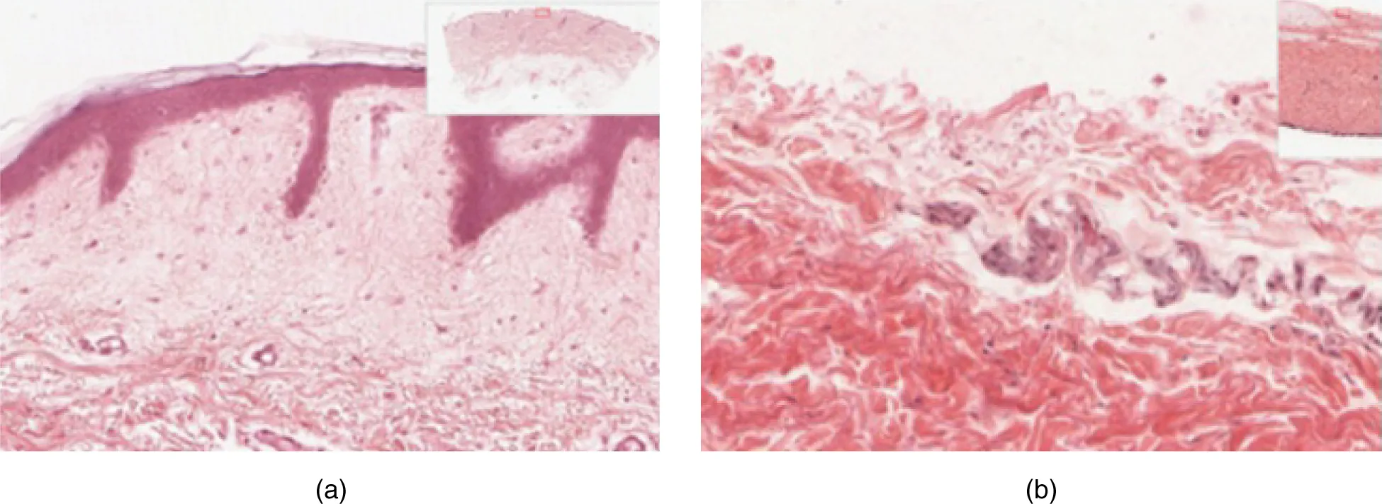 Part A is a micrograph showing a cross section of thin skin. The topmost layer is a thin, translucent layer with irregular texture and areas where cells are sloughing off. The deepest layer is dark purple and extends into the third layer with finger like projections. The third light purple layer contains thin bands of fibers and small, dark cells. The fourth, and deepest layer, is darker than the third layer, but is still light purple. It contains thick fiber bands that are loosely packed. Part B is a magnified view of the epidermis of thick skin. It shows the topmost layer is five times thicker than the topmost layer of thin skin. The topmost layer of thick skin is also denser and less translucent than the topmost layer of thin skin.