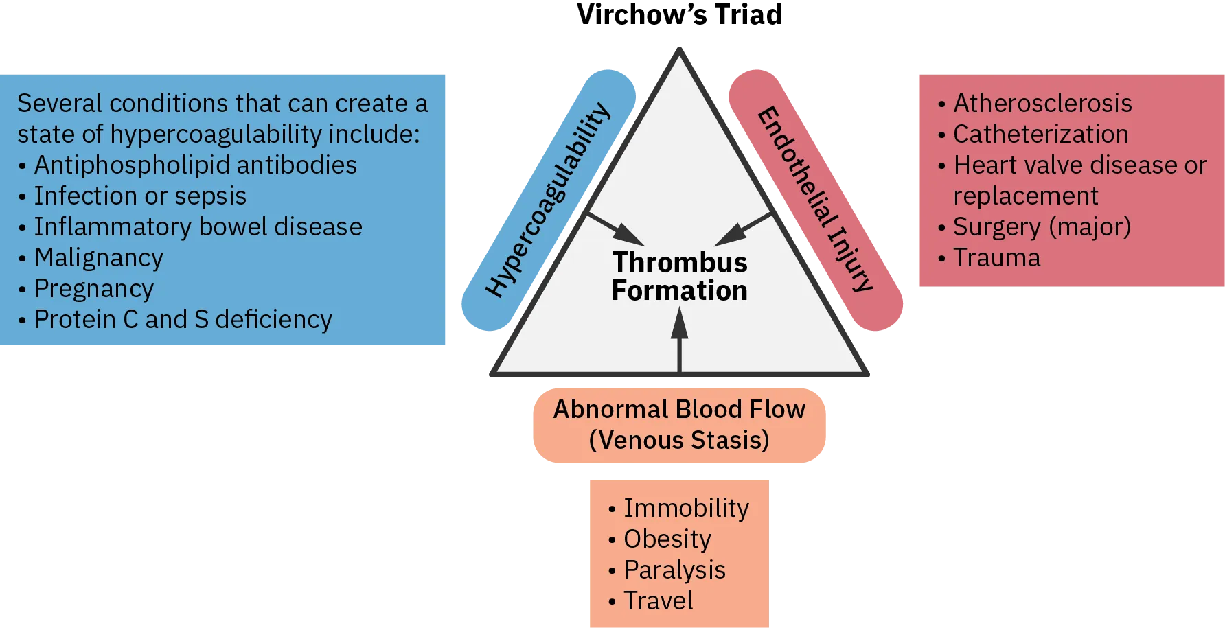 The points of Virchow's Triad are Endothelial industry, Venous stasis, and hypercoagulable state. There are double-sided arrows between each point. Moving between endothelial industry and venous stasis can occur due to surgery, trauma, indwelling catheters, atherosclerosis, and heart valve disease or replacement. Moving between venous stasis and hypercoagulable state can occur due to immobility, travel, and obesity. Moving between hypercoagulable state and endothelial injury can occur due to malignancy, pregnancy, protein C and S deficiency, and antiphospholipid antibodies.