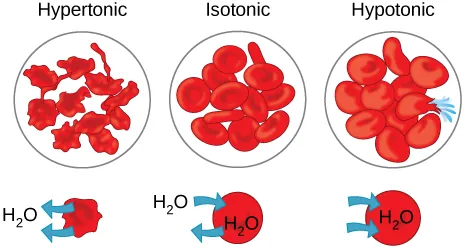 The left part of this illustration shows shriveled red blood cells bathed in a hypertonic solution. The middle part shows healthy red blood cells bathed in an isotonic solution, and the right part shows bloated red blood cells bathed in a hypotonic solution.