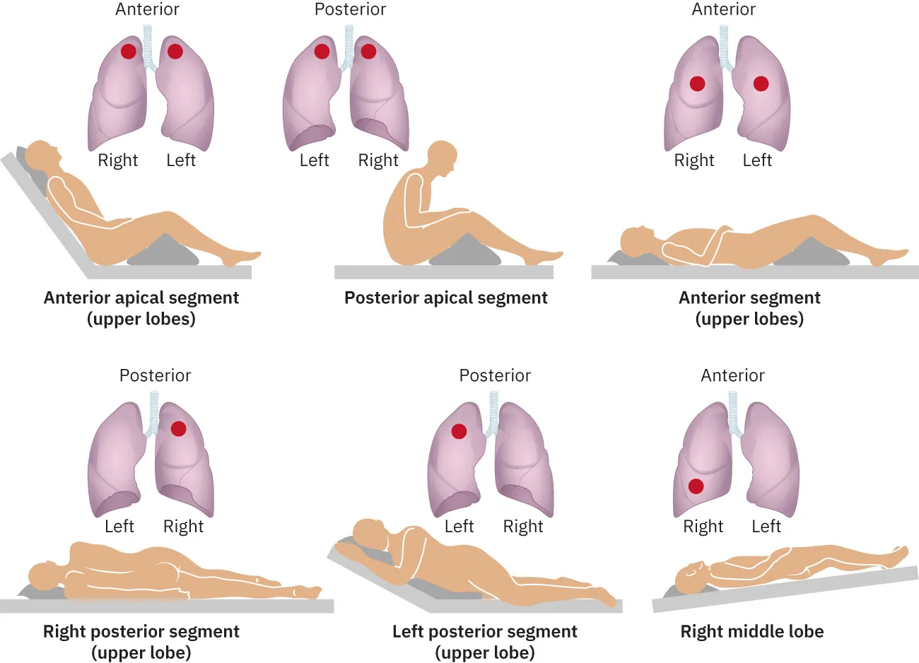 A diagram showing different positions and examples of postural drainage.