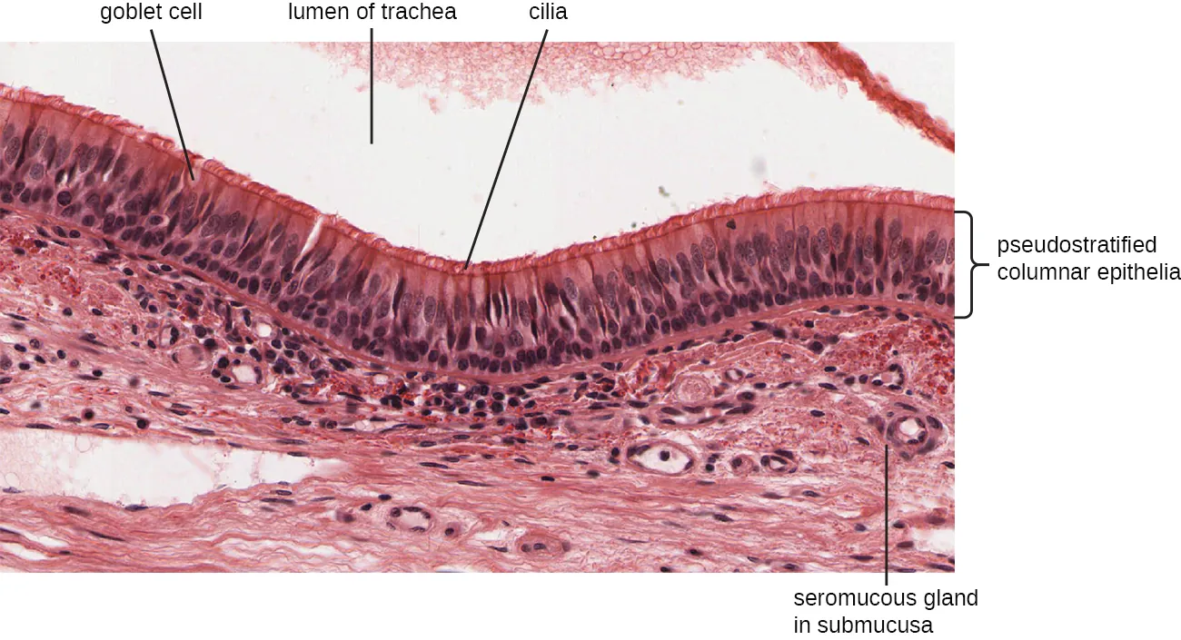 A micrograph of the trachea. Description below.