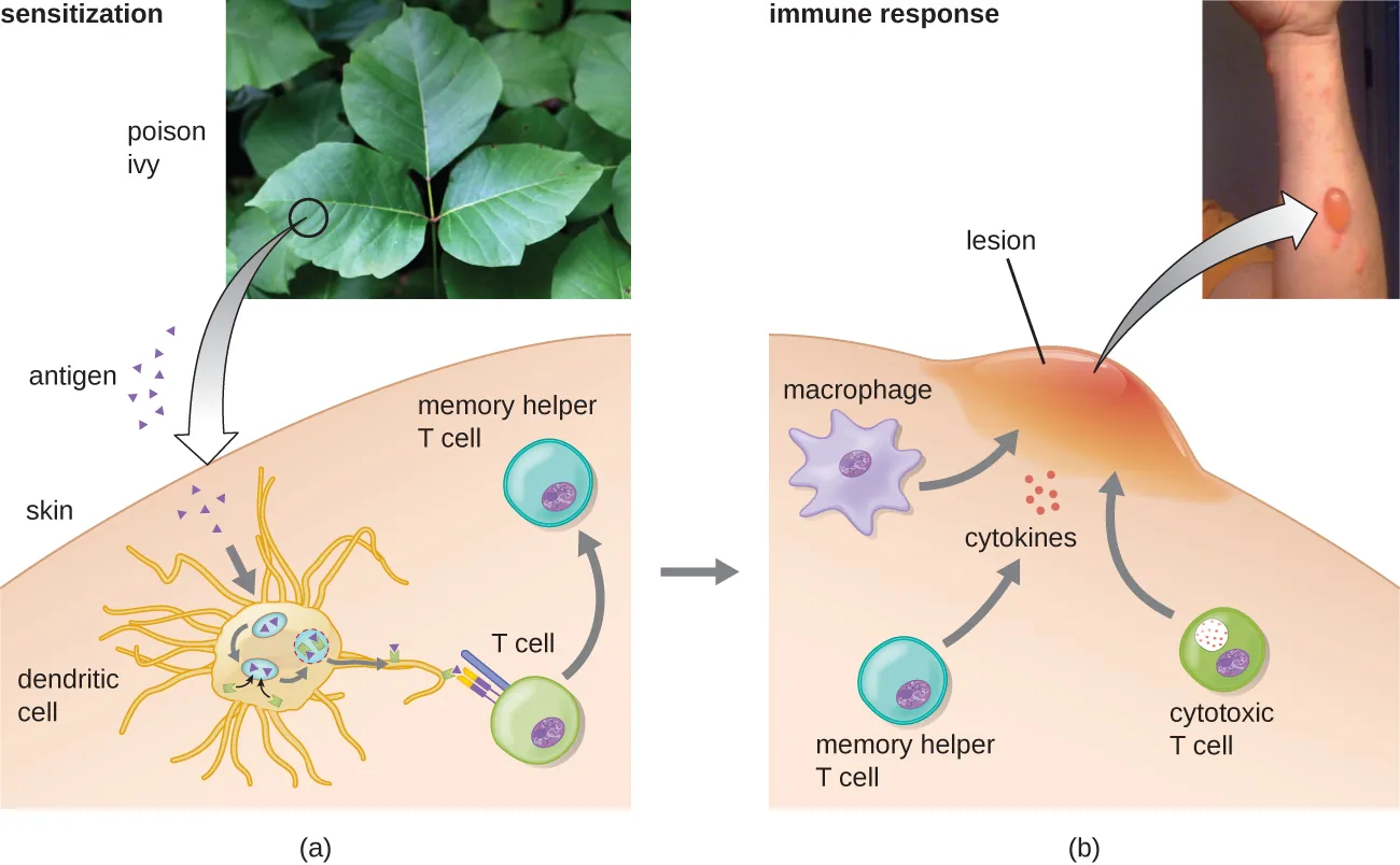 Sensitization and immune response. Description below.