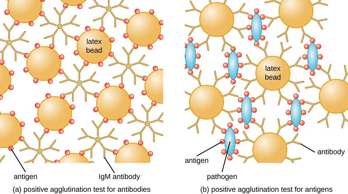 A diagram of positive agglutination test for antibodies. Description below.