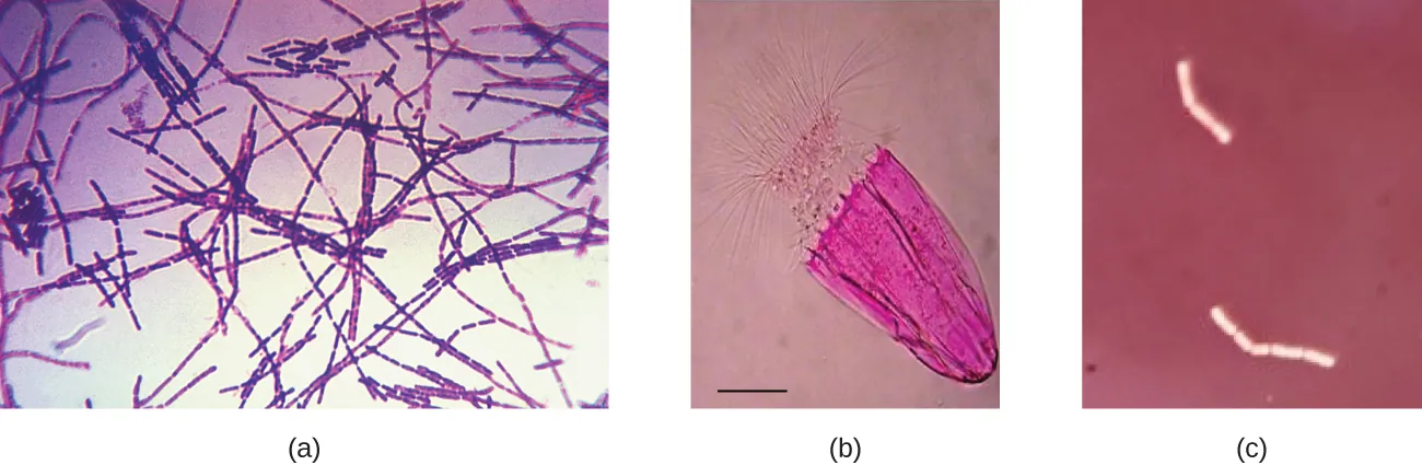 Negative staining. Description below.