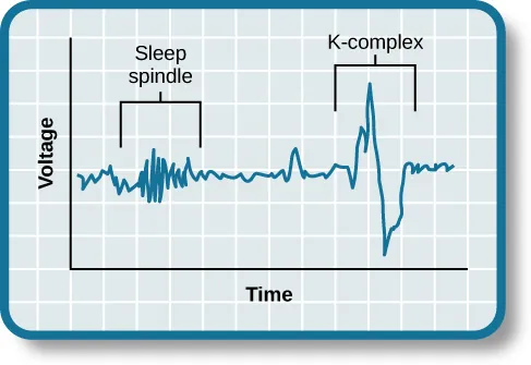 A graph has an x-axis labeled “time” and a y-axis labeled “voltage. A line illustrates brainwaves, with two areas labeled “sleep spindle” and “k-complex”. The area labeled “sleep spindle” has decreased wavelength and moderately increased amplitude, while the area labeled “k-complex” has significantly high amplitude and longer wavelength.
