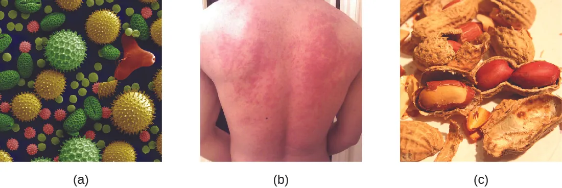A) micrograph of pollen granules in different shapes and with different surface features. B) photo of a rash on a person&rsquo;s back. C) Photo of peanuts.