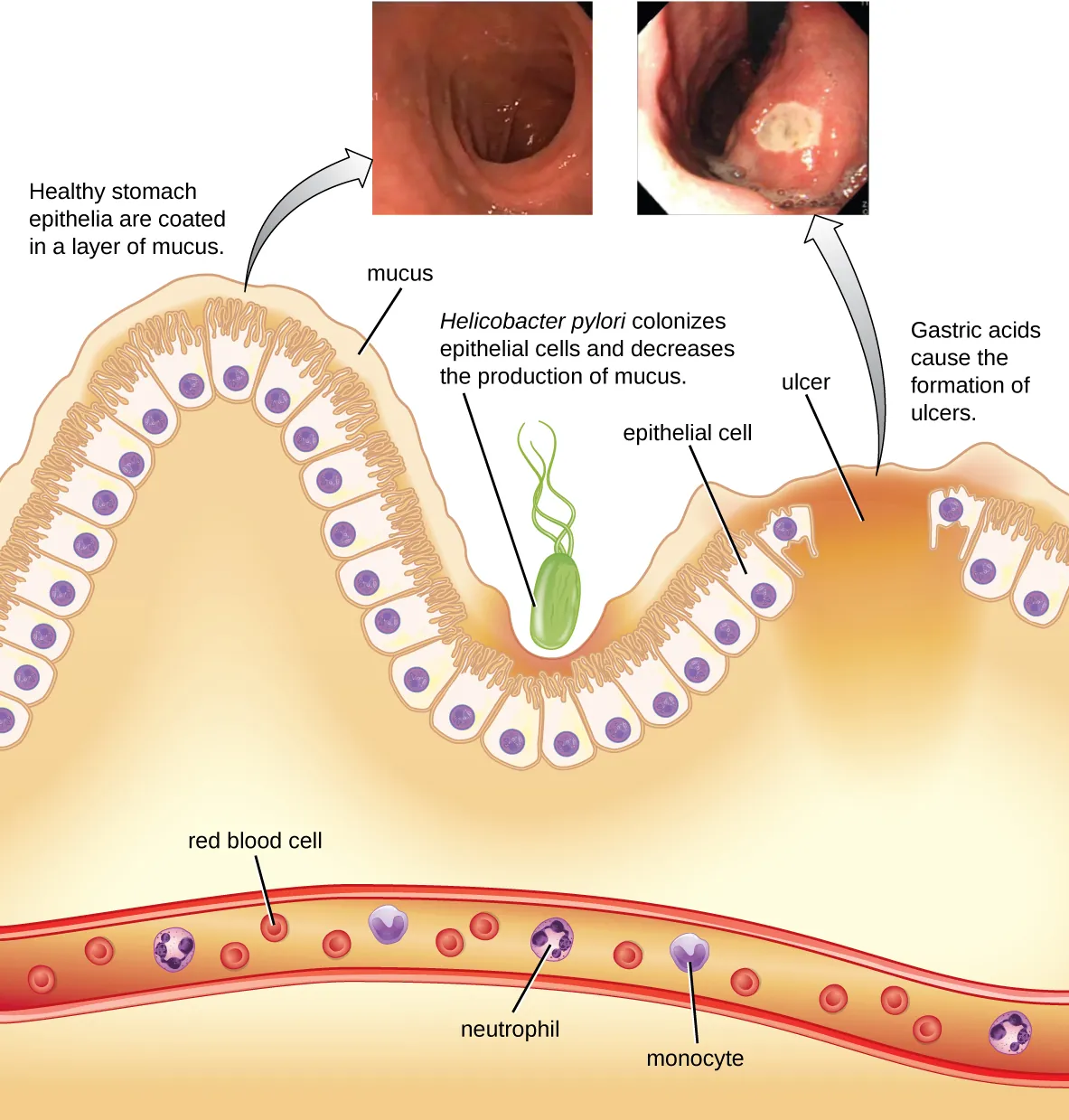 Lining of the stomach. Description below.