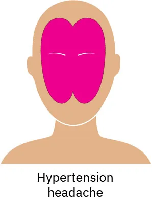 A drawing of a person’s face with a pink highlight on the middle area, showing where pain caused by hypertension is reflected.