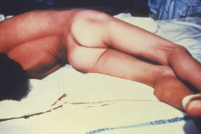 A person in an arched position.