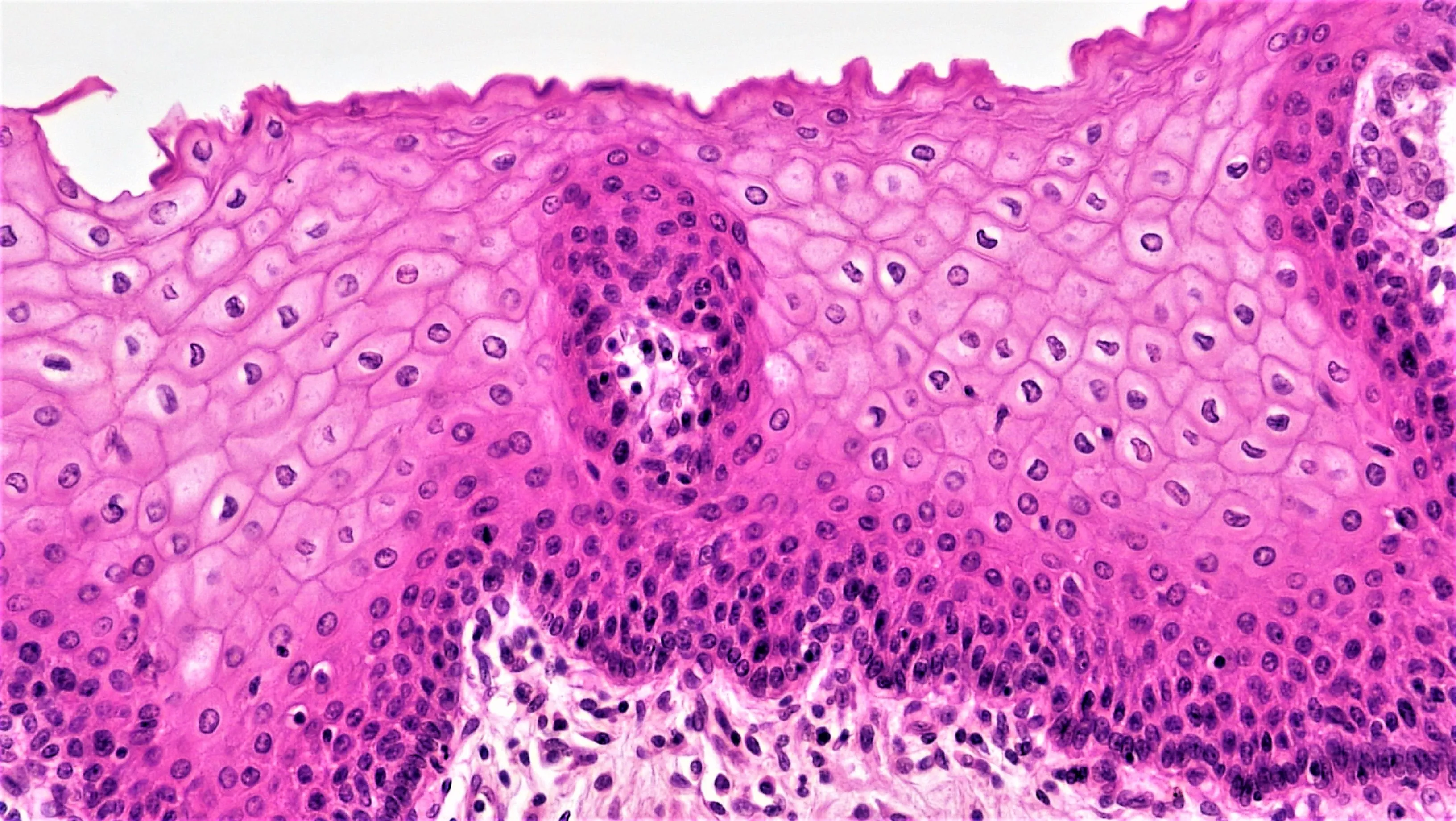 A micrograph of a cross section of stratified squamous epithelium, stained pink. The cells are flat and thin.