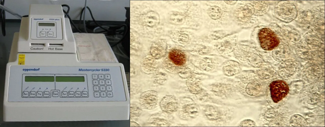 Thermocylcer detects Chlamydia trachomatis. Description in caption.