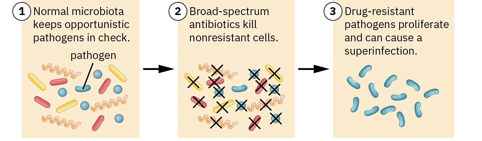 A diagram shows how broad-spectrum antibiotics can lead to superinfections. A normal microbiota keeps opportunistic pathogens in check. However, broad-spectrum antibiotics can kill all nonresistant cells, including the microbiota. This results in drug-resistant pathogens proliferating, without the normal microbiota to keep them in check.