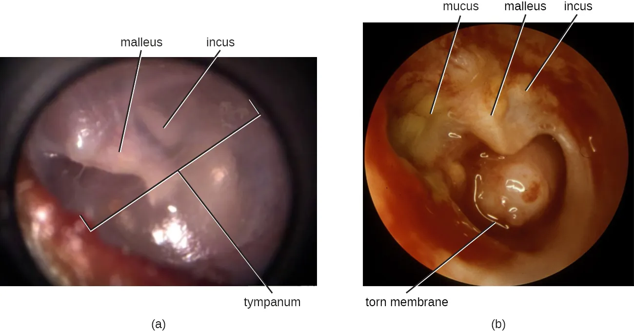The ear drum. Description below.