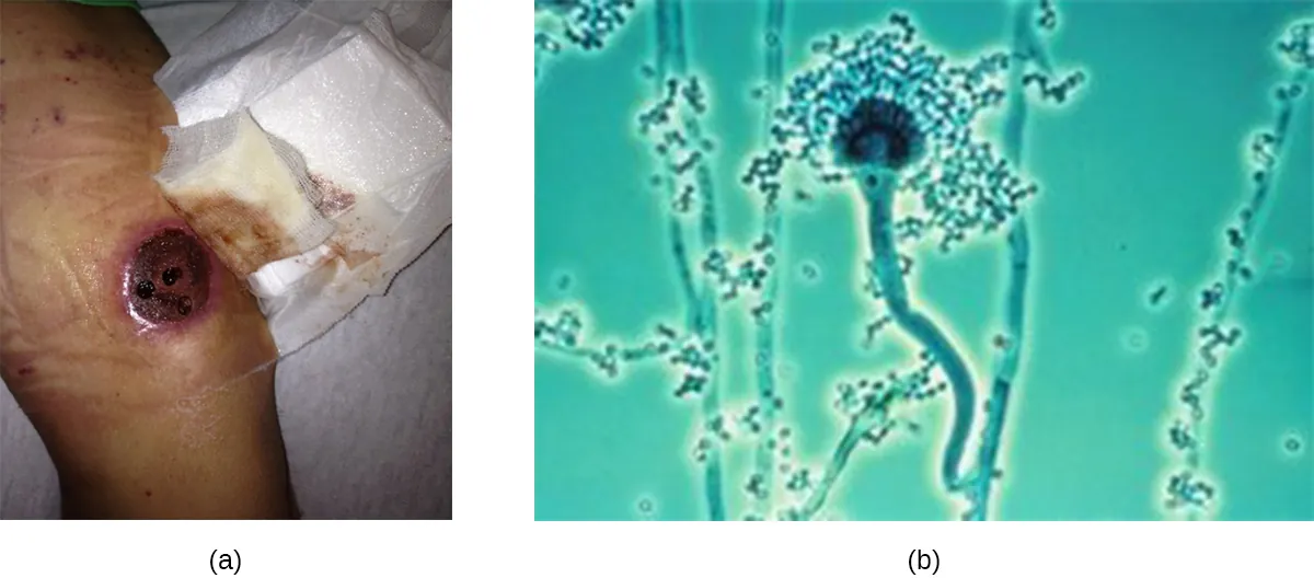 A large, round, dark area on their leg. Many strands and small dots. One of the strands ends in a sphere with long chains of dots around the top part of the structure.
