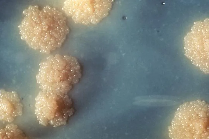 M. Tuberculosis. Description in caption.