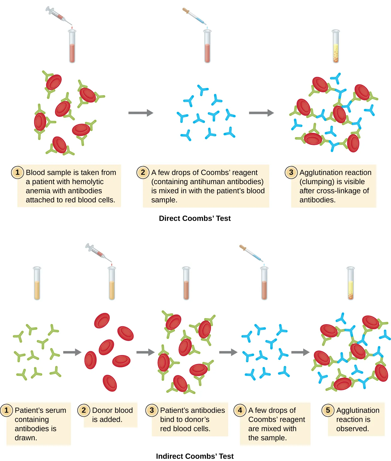 Diagram of direct Coomb&rsquo;s test. Description below.