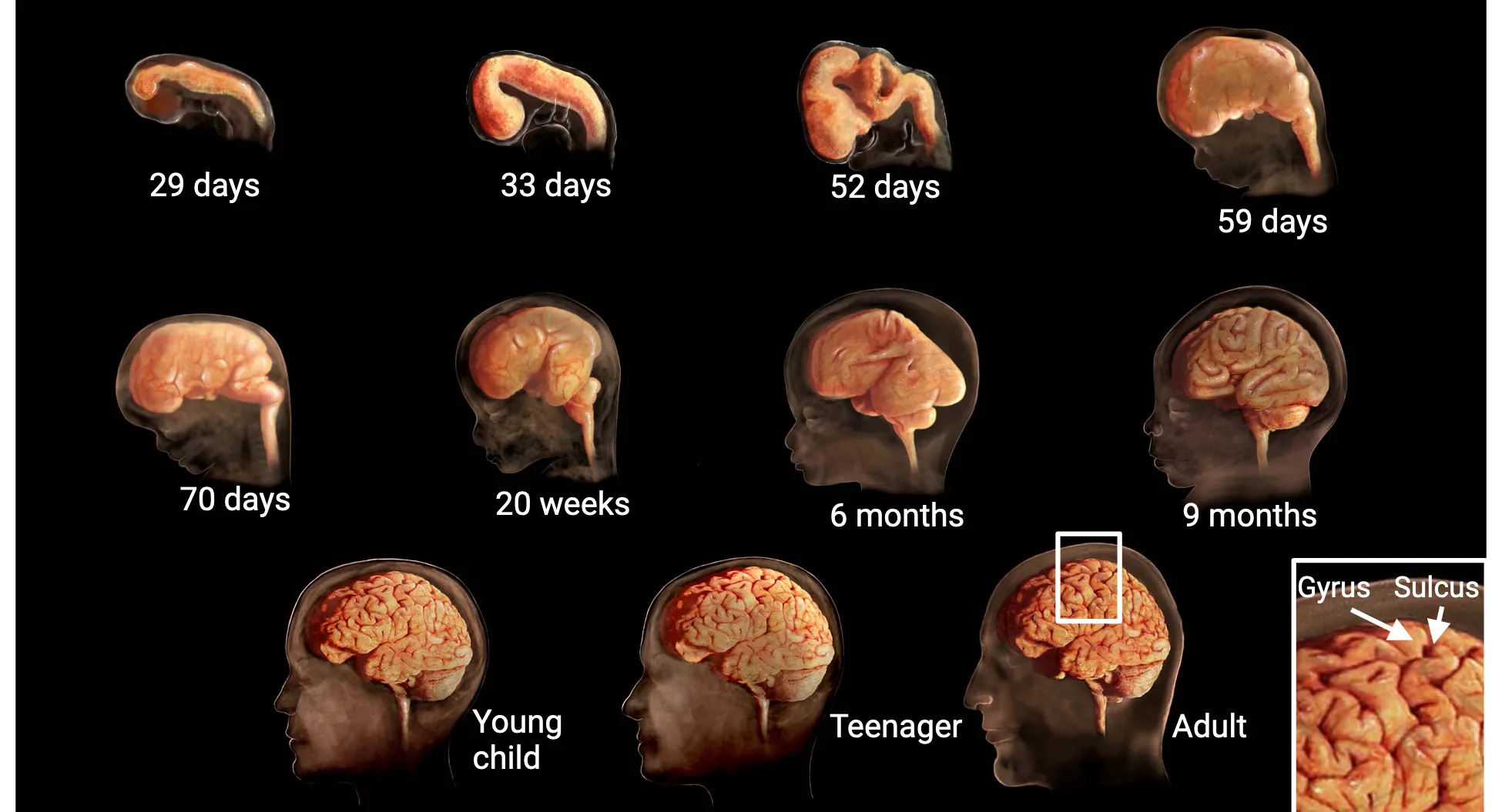 Illustration of human brain viewed laterally from 29 days of embryonic development to birth and then from young child to adult. The brain is seen growing from a single, smooth neural tube to the complex adult brain with sulci and gyri. The main text explains relevant major changes. The cephalic flexure first arises at 33 days embryonic and more thorough curling over of the telencephalon is seen around 52 days. Sulci and gryi gradually emerge day 70-6mo embryonic, but more adult patterns of sulci and gyri are not evident until 9months/birth.
