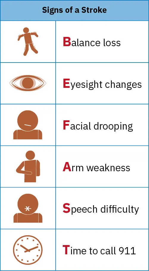 Chart showing signs of a stroke with the acronym FAST: Facial drooping, Arm weakness, Speech difficulty, Time to call 911