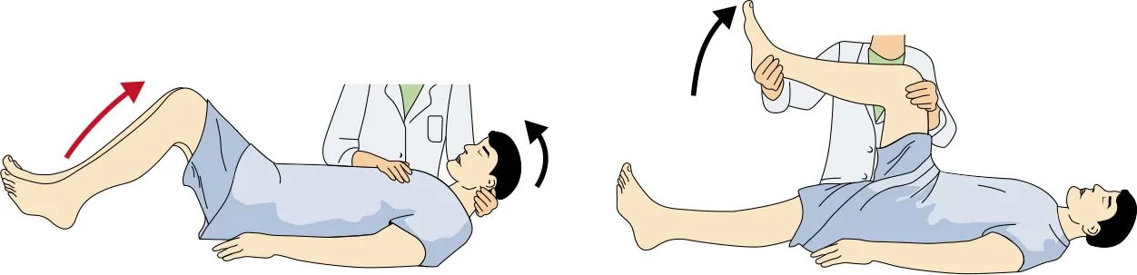 Illustration of (left) pressure applied to the pubic symphysis, eliciting reflex hip and knee flexion, abduction of the leg; (right) supine patient, hip and knee flexed to right angle, knee slowly extended.