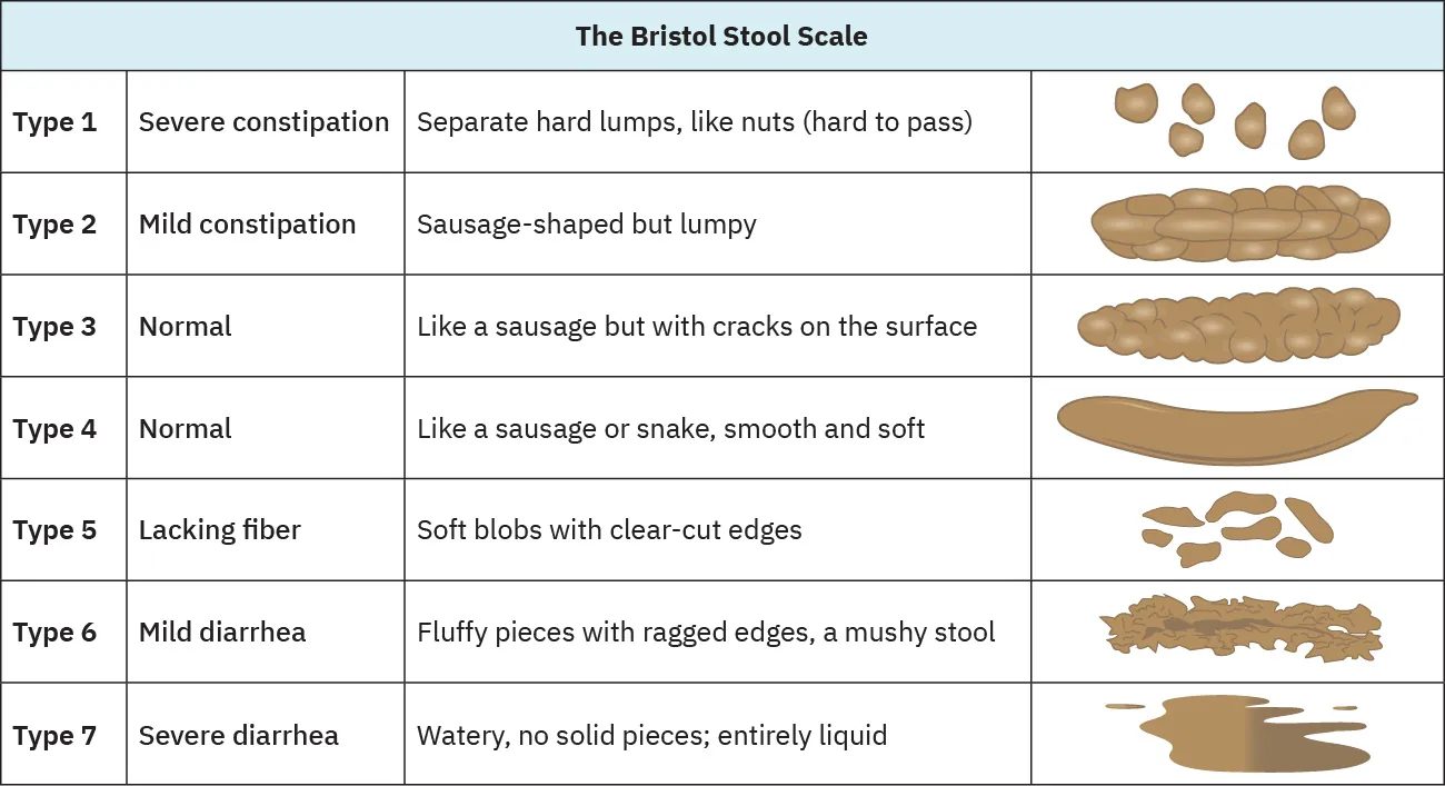 A chart depicting the Bristol Stool Scale, which is a medical aid designed to classify the form of human feces into seven categories. Each type is numbered 1 through 7 and is associated with a specific condition, such as 'severe constipation' for Type 1, or 'severe diarrhea' for Type 7. Descriptions and illustrative representations accompany each type, ranging from 'separate hard lumps' for Type 1 to 'watery, no solid pieces' for Type 7.