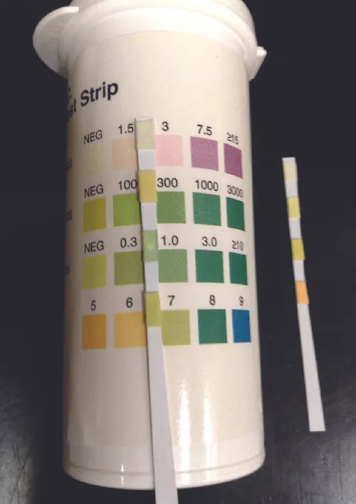 Urine dipstick.