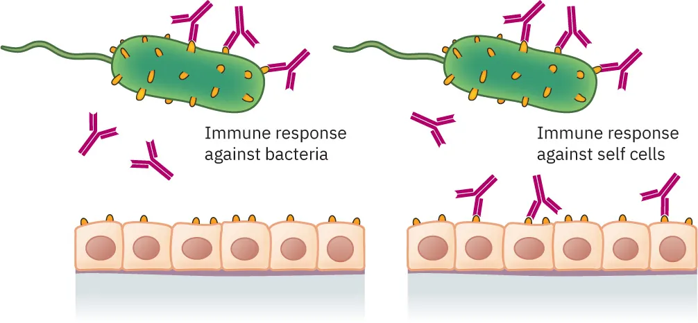 A diagram contrasting two types of immune responses: one against bacteria and the other against self cells. On the left, it shows the immune response targeting bacteria, and on the right, it illustrates the immune response mistakenly targeting the body’s own cells, characteristic of autoimmune diseases.
