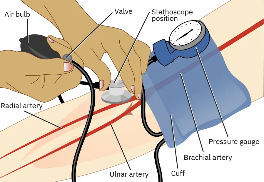 Image showing how to manually take a patient’s blood pressure.