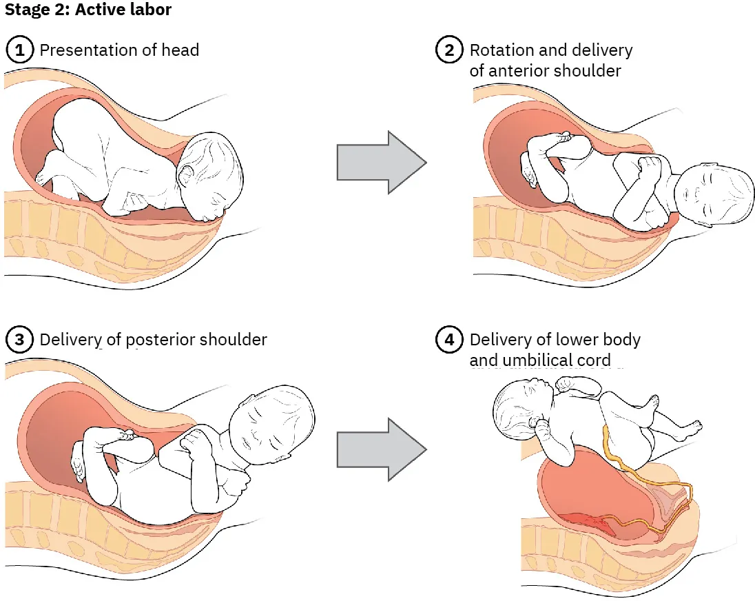 Illustration of Stage 2: Active Labor. 1. Presentation of head. 2. Rotation and delivery of anterior shoulder. 3. Delivery of posterior shoulder. 4. Delivery of lower body and umbilical cord.