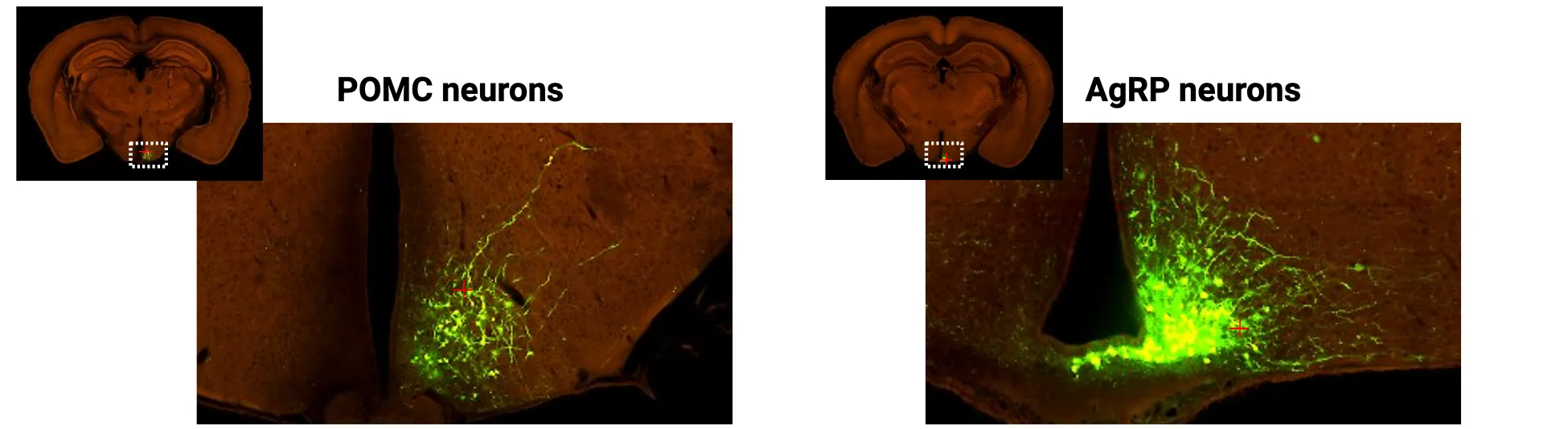 Green fluorescent tracers reveal POMC and AgRP cell bodies and axons in the arcuate nucleus, which look like clusters of green fibers just lateral to the 3rd ventricle in coronal sections of mouse brain.