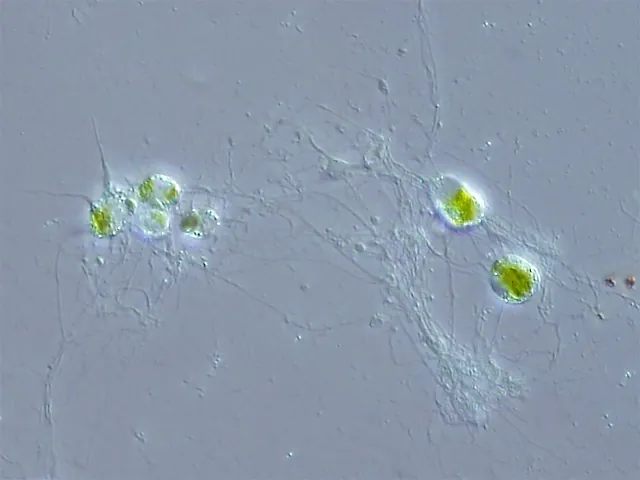 Image is a Chlorarachniophyte. It appears as a series of green cells with what appear to be fibers surrounding and connecting them.