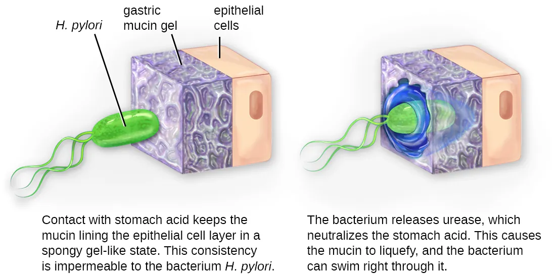 Diagram of H. pylori invading the lining of the stomach. Description below.