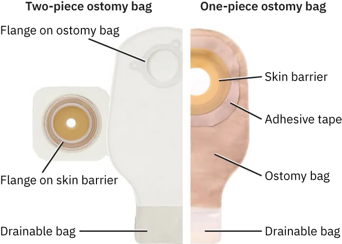 Illustration showing Two-piece ostomy bag, labeling Flange on ostomy bag, Flange on skin barrier, and Drainable bag; One-piece ostomy bag, labeling Skin barrier, Adhesive tape, Ostomy bag, and Drainable bag.