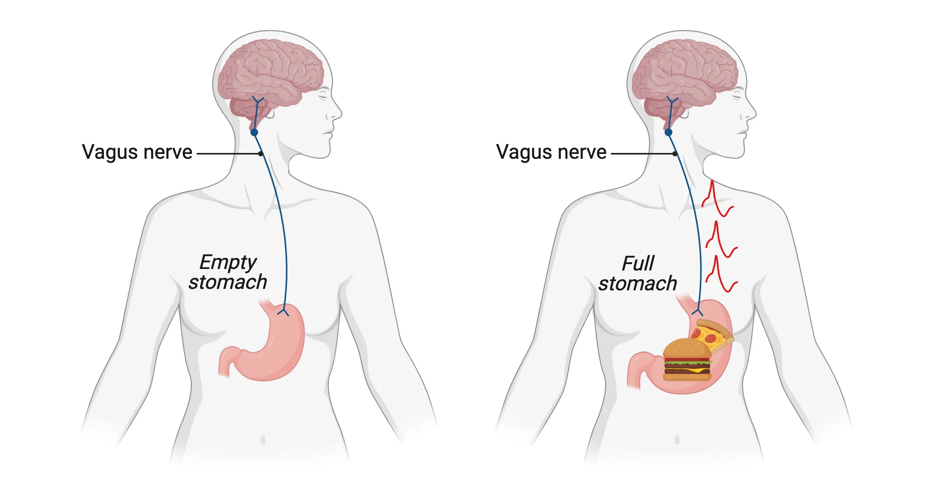 Two diagrams of human torso with brain and stomach connected by vagus nerve in the brainstem. 1) Empty stomach, vagus nerve is silent. 2) Full stomach.