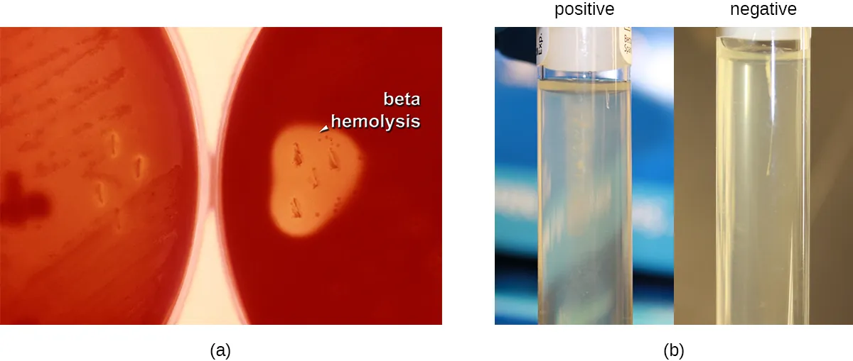 Agar and motility tests. Descriptions below.