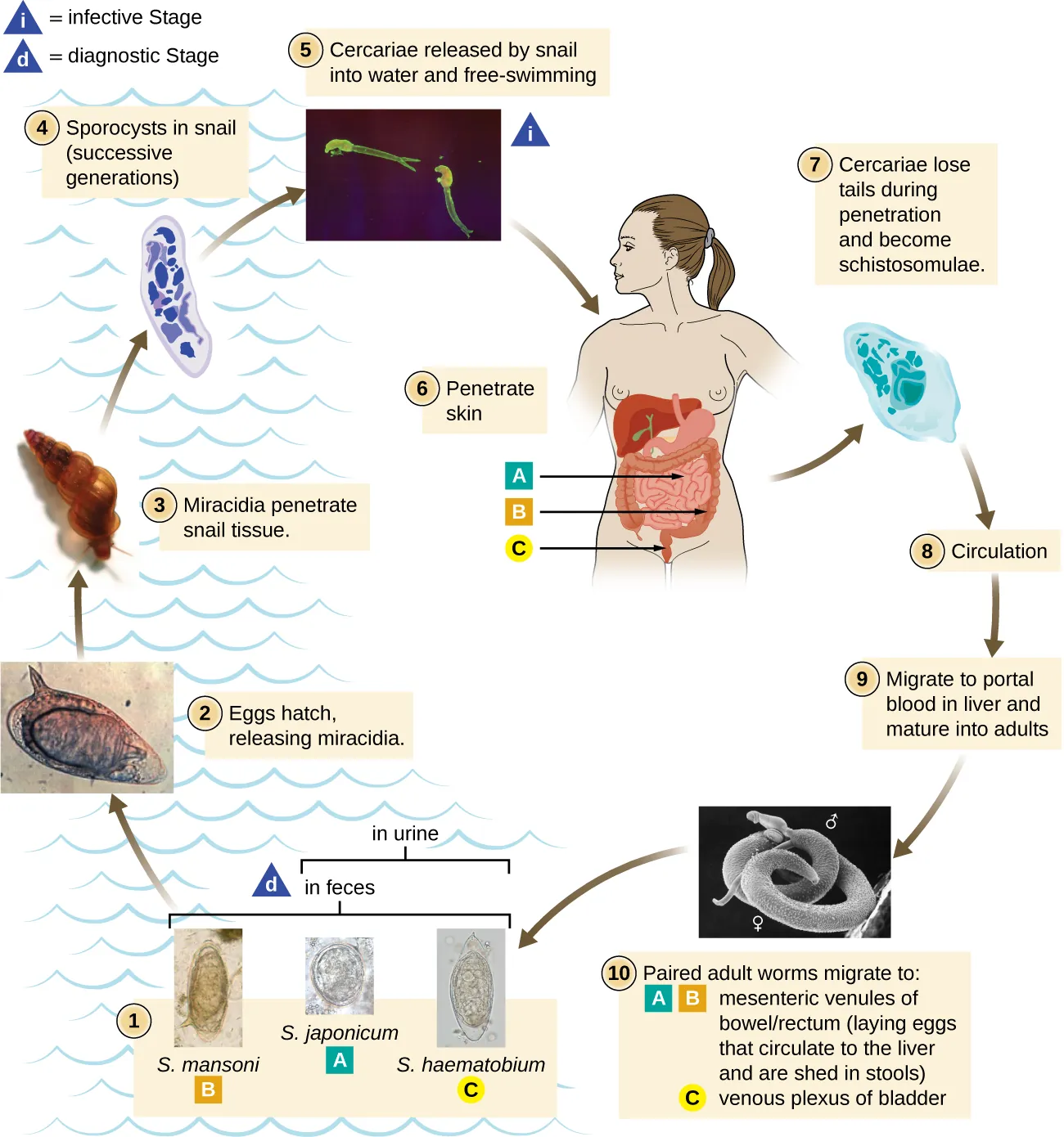 Schistosomiasis. Description below.