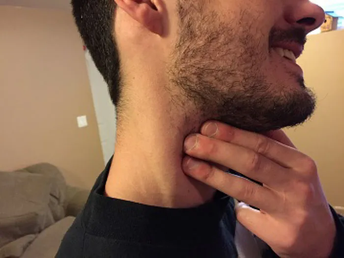 A photo of a man with his hand on his trachea, palpating the carotid pulse.