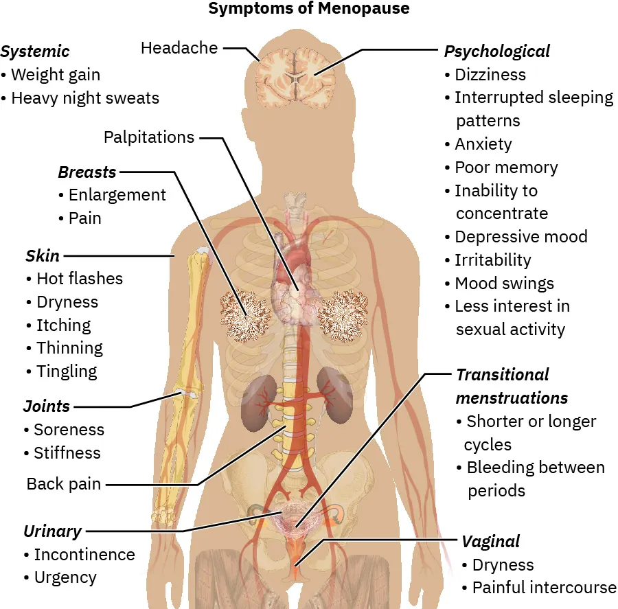 Symptoms of Menopause: headache, palpitations, Systemic (weight gain, night sweats) Breasts (enlargement, pain), Skin (hot flashes, dryness, itching, thinning, tingling), Joints (soreness, stiffness), Back pain, Urinary (incontinence, urgency), Psychological (dizziness, interrupted sleeping patterns, anxiety, poor memory, inability to concentrate, depressive mood, irritability, mood swings, less interest in sexual activity), Transitional menstruations (shorter/longer cycles, bleeding between periods), Vaginal (dryness, painful intercourse).