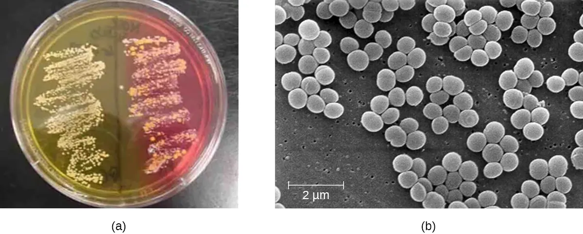 Staphylococcal Infections of the Skin. Description below.